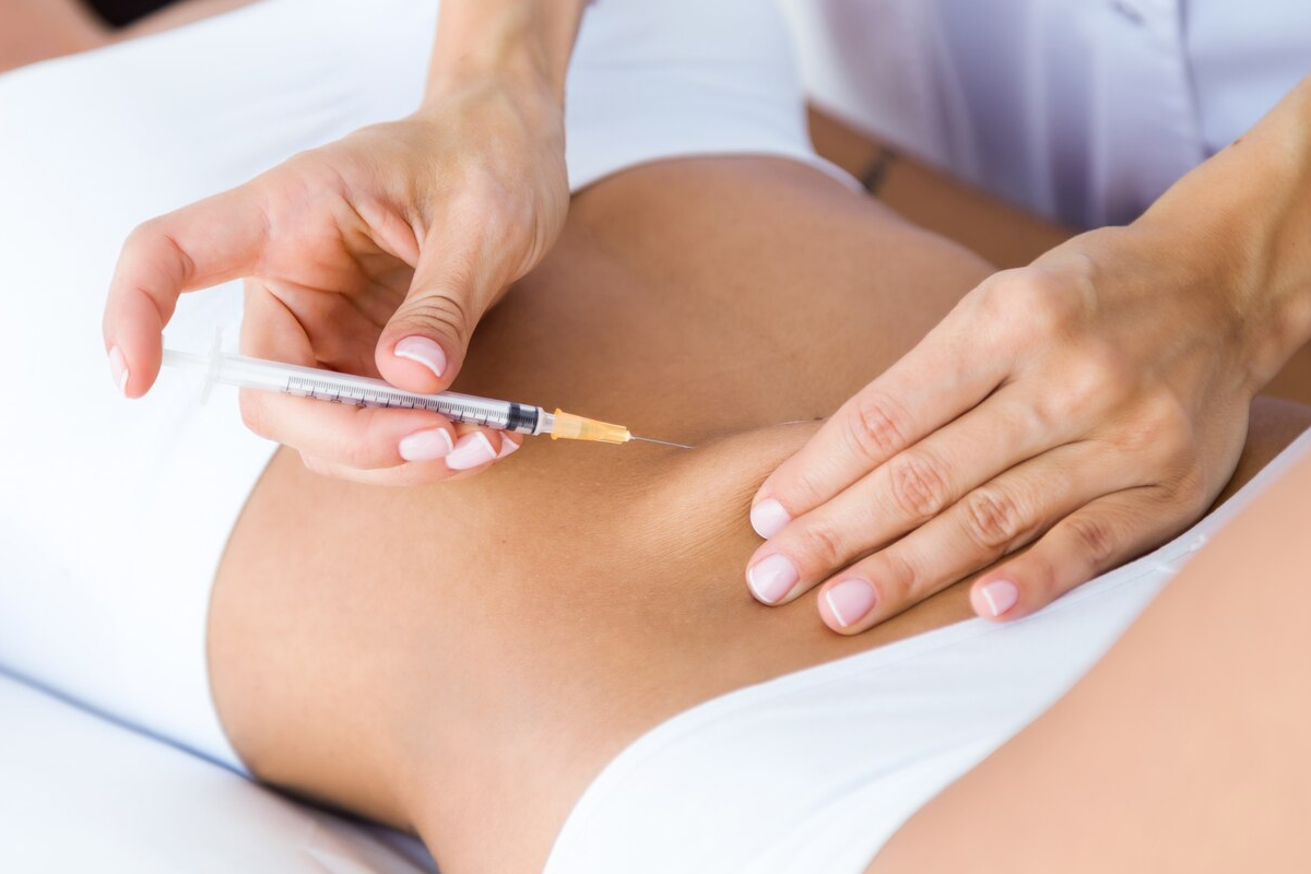 Bioestimuladores de Colágeno Corporal